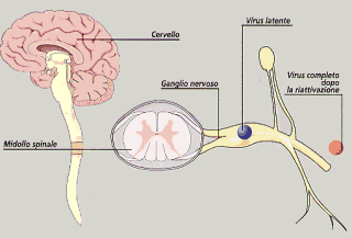 Herpes simplex