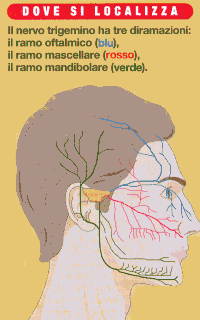 Nevralgia del trigemino