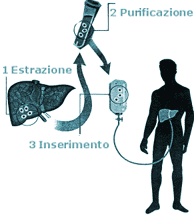 Glicogenosi epatica