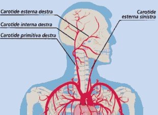 Ictus