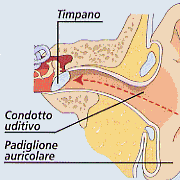 Tappi di cerume